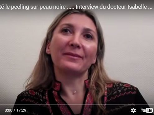 interview peeling